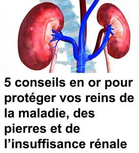 5 conseils en or pour protéger vos reins de la maladie des pierres et