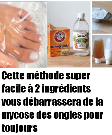 Cette Méthode Super Facile à 2 Ingrédients Vous Débarrassera