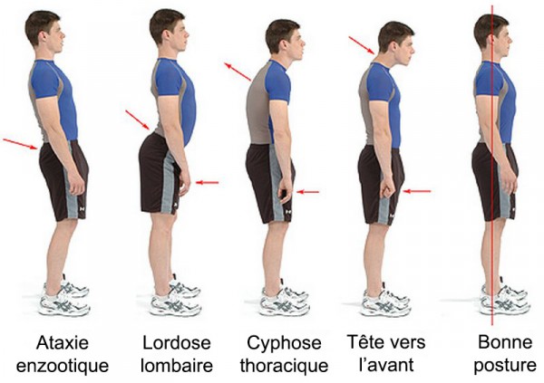 6 Mauvaises Postures Qui Affectent Votre Santé Et Comment Les Corriger