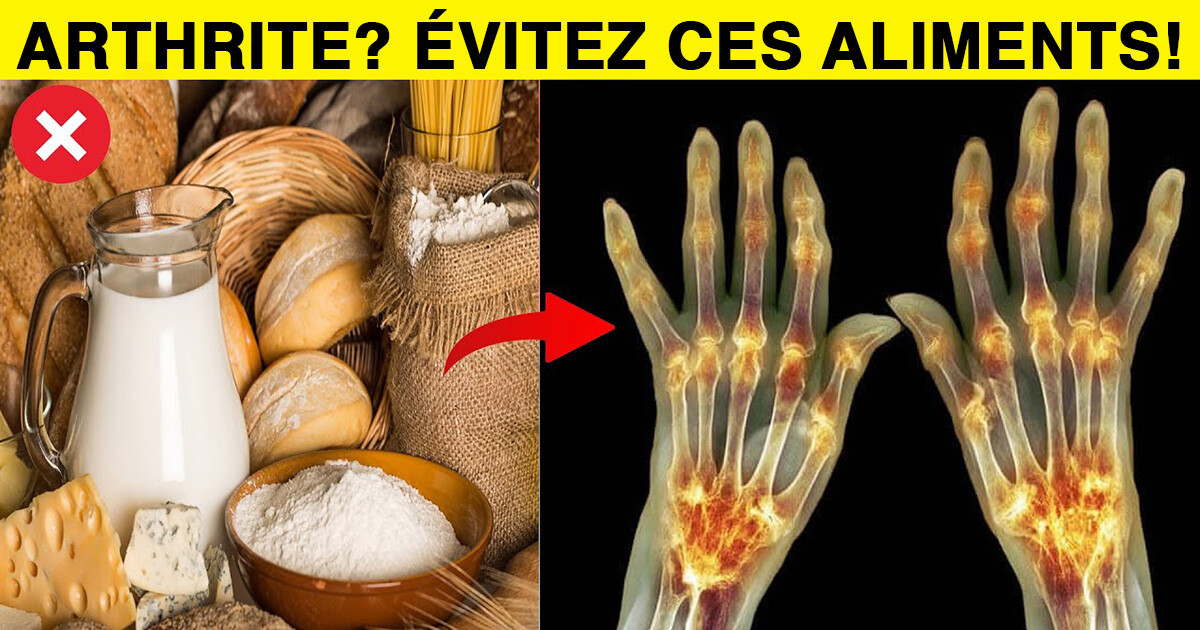 Aliments Viter Si Vous Souffrez D Arthrite Sant Nutrition